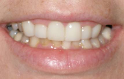 Healthy and beautifully repaired smile