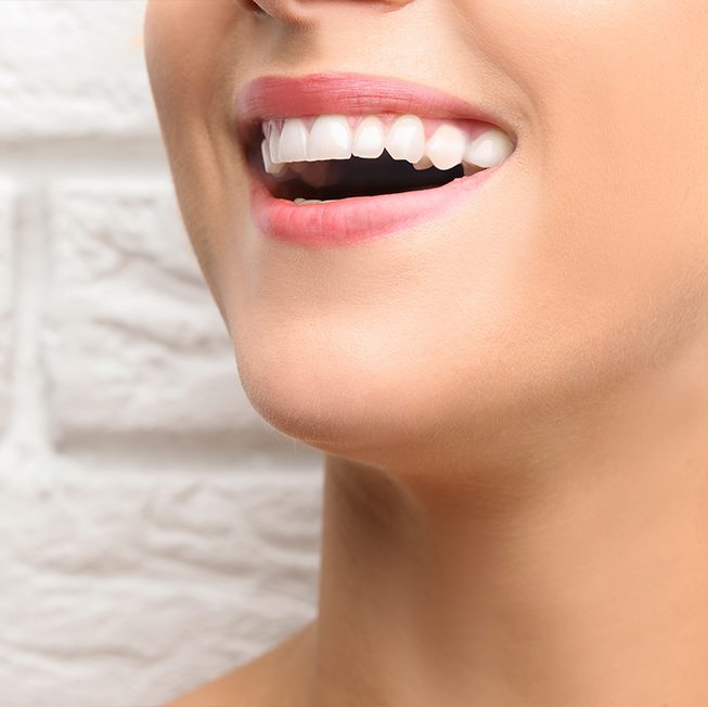 Closeup of beautiful smile after cosmetic dental bonding