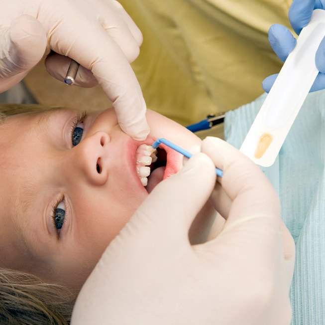 Child receiving fluoride treatment