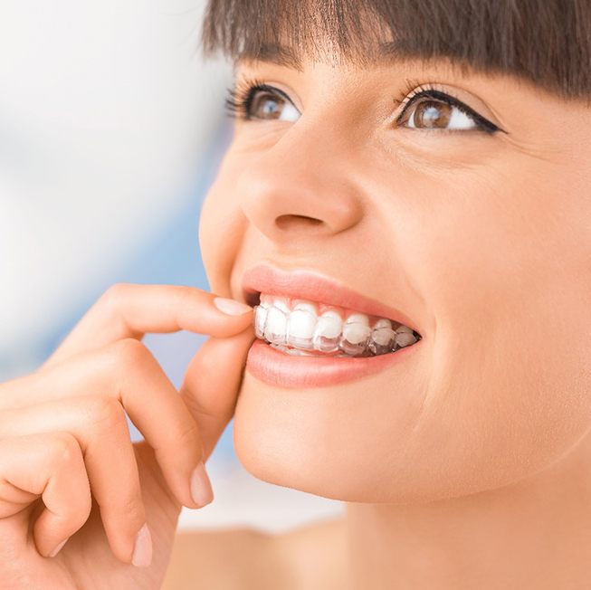 taking out Invisalign aligner in Corpus Christi