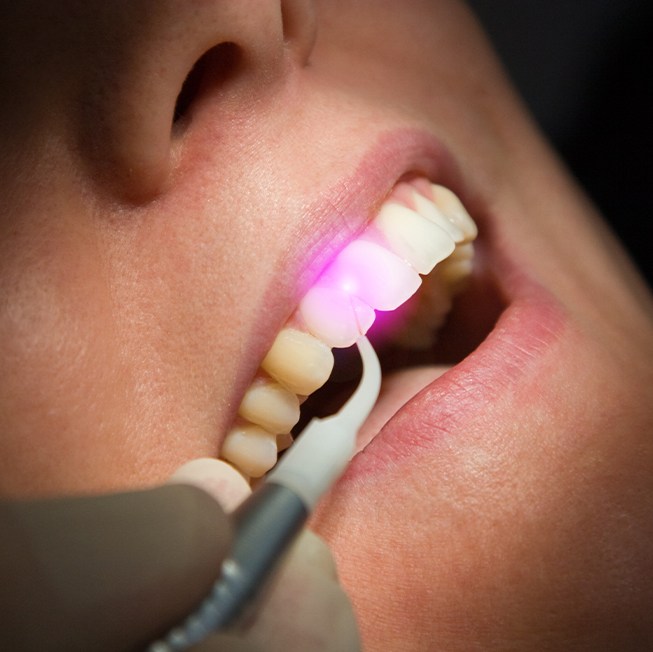 Patient receiving soft tissue laser dentistry treatment