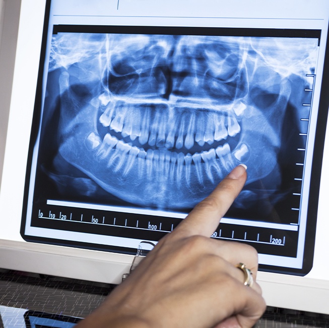 Digital x-rays on chairside computer screen