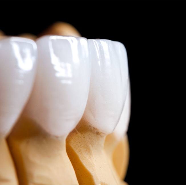 man admiring his smile with veneers in Corpus Christi